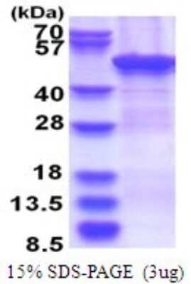 SDS-PAGE: Recombinant Human ZCCHC12 His Protein [NBP2-51716]