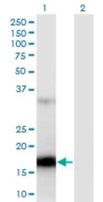 Western Blot: ZCCHC13 Antibody (4G11) [H00389874-M02]