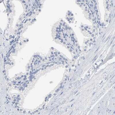 Immunohistochemistry-Paraffin: ZCCHC13 Antibody [NBP1-92604]