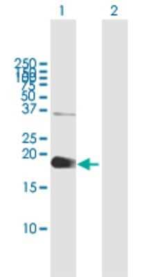 Western Blot: ZCCHC13 Antibody [H00389874-B01P]