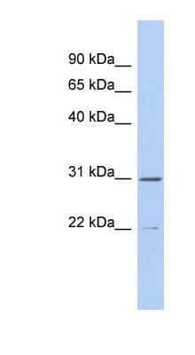 Western Blot: ZCCHC13 Antibody [NBP1-56809]