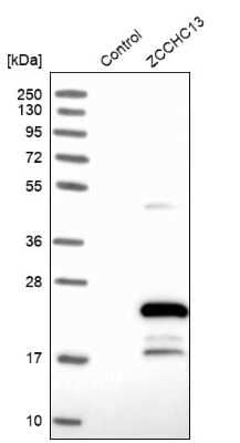 Western Blot: ZCCHC13 Antibody [NBP1-92604]