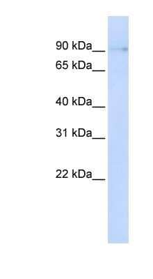 Western Blot: ZCCHC14 Antibody [NBP1-56777]