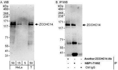 Western Blot: ZCCHC14 Antibody [NBP1-71852]