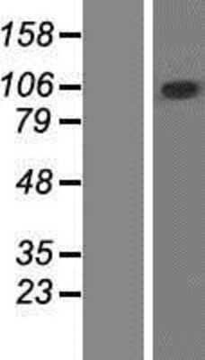 Western Blot: ZCCHC14 Overexpression Lysate [NBP2-07204]