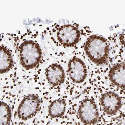 Immunohistochemistry-Paraffin: ZCCHC16 Antibody [NBP1-81888]