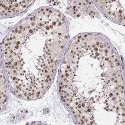 Immunohistochemistry: ZCCHC17 Antibody [NBP2-68707]