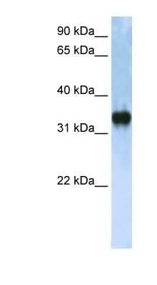 Western Blot: ZCCHC17 Antibody [NBP1-57282]