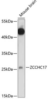 Western Blot: ZCCHC17 AntibodyAzide and BSA Free [NBP2-93959]