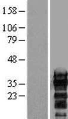 Western Blot: ZCCHC17 Overexpression Lysate [NBL1-17992]