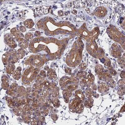 Immunohistochemistry-Paraffin: ZCCHC2 Antibody [NBP1-82192]