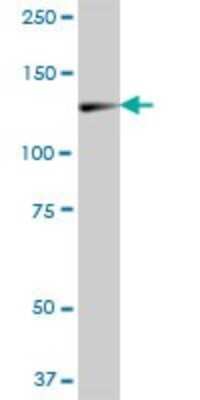 Western Blot: ZCCHC2 Antibody [H00054877-B01P]