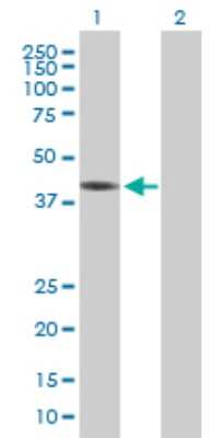 Western Blot: ZCCHC2 Antibody [H00054877-B01P]