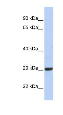 Western Blot: ZCCHC24 Antibody [NBP1-56437]