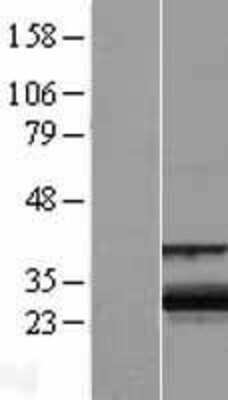 Western Blot: ZCCHC24 Overexpression Lysate [NBL1-17993]