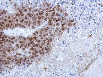 Immunohistochemistry-Paraffin: ZCCHC4 Antibody [NBP2-20939]