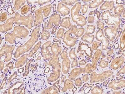 Immunohistochemistry-Paraffin: ZCCHC4 Antibody [NBP2-97816]