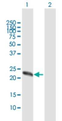 Western Blot: ZCCHC4 Antibody [H00029063-B01P]