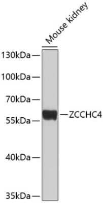 Western Blot: ZCCHC4 AntibodyBSA Free [NBP2-93218]