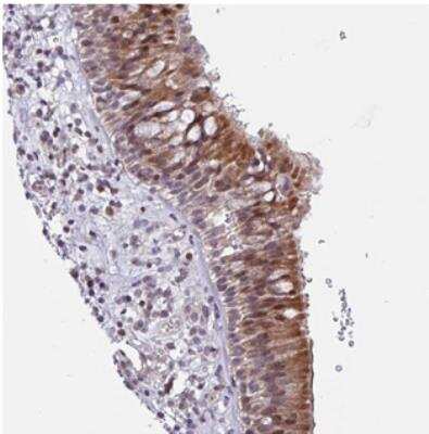 Immunohistochemistry: ZCCHC5 Antibody [NBP2-30741]