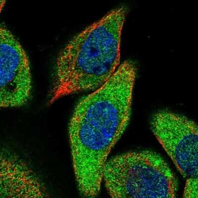 Immunocytochemistry/ Immunofluorescence: ZCCHC6 Antibody [NBP1-82257]