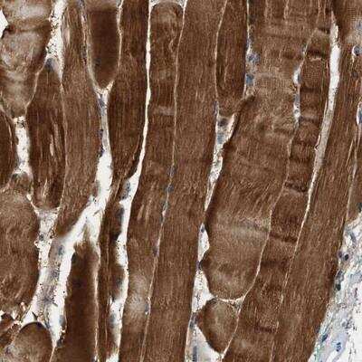 Immunohistochemistry-Paraffin: ZCCHC6 Antibody [NBP1-82257]