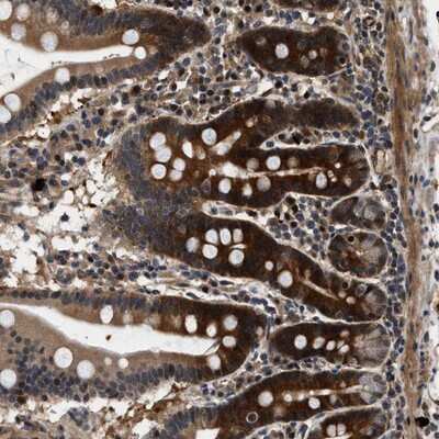 Immunohistochemistry-Paraffin: ZCCHC6 Antibody [NBP1-82258]