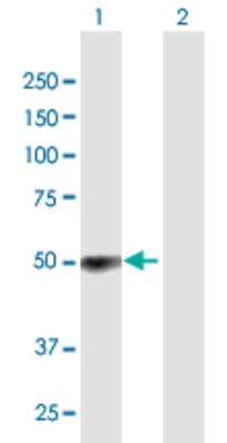 Western Blot: ZCCHC6 Antibody [H00079670-B01P]