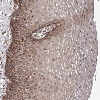 Immunohistochemistry-Paraffin: ZCCHC7 Antibody [NBP1-89175]