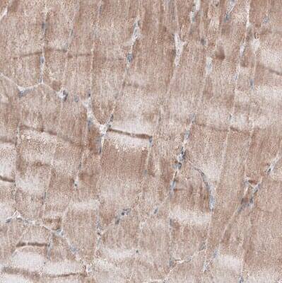 Immunohistochemistry-Paraffin: ZCCHC7 Antibody [NBP1-89176]