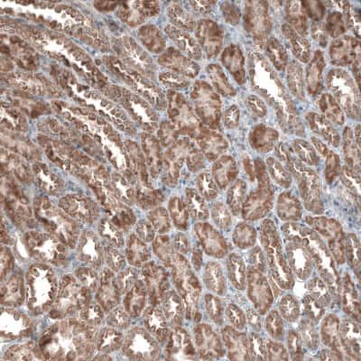 Immunohistochemistry-Paraffin: ZCCHC7 Antibody [NBP1-89176]