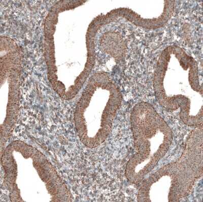 Immunohistochemistry-Paraffin: ZCCHC7 Antibody [NBP1-89176]