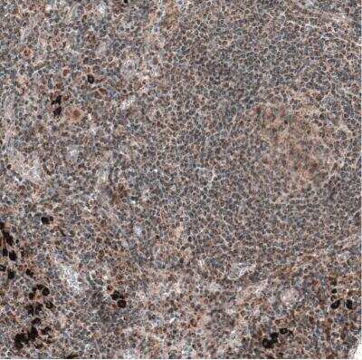 Immunohistochemistry-Paraffin: ZCCHC7 Antibody [NBP1-89176]