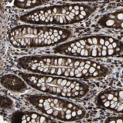 Immunohistochemistry-Paraffin: ZCCHC7 Antibody [NBP1-89177]