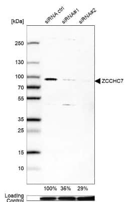 Western Blot: ZCCHC7 Antibody [NBP1-89175]