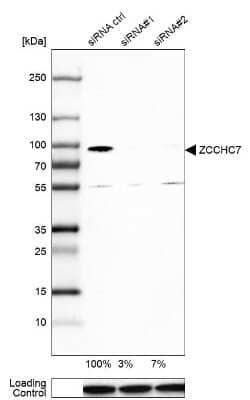 Western Blot: ZCCHC7 Antibody [NBP1-89176]