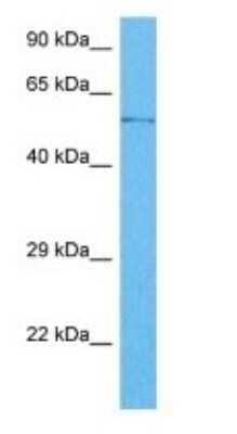 Western Blot: ZCCHC7 Antibody [NBP3-09396]