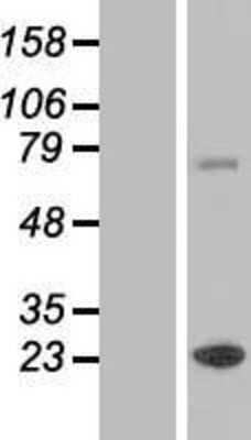 Western Blot: ZCCHC7 Overexpression Lysate [NBL1-17994]