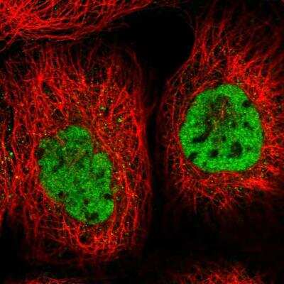 Immunofluorescence: ZCCHC8 Antibody [NBP1-85134]