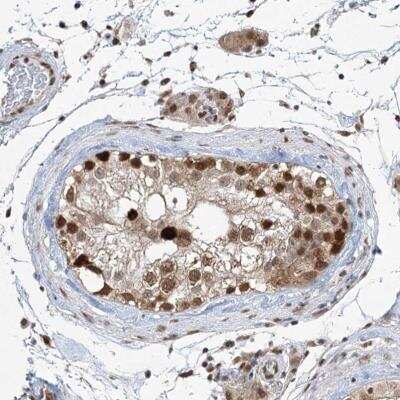 Immunohistochemistry: ZCCHC8 Antibody [NBP1-85134]