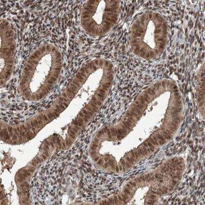Immunohistochemistry: ZCCHC8 Antibody [NBP1-85134]