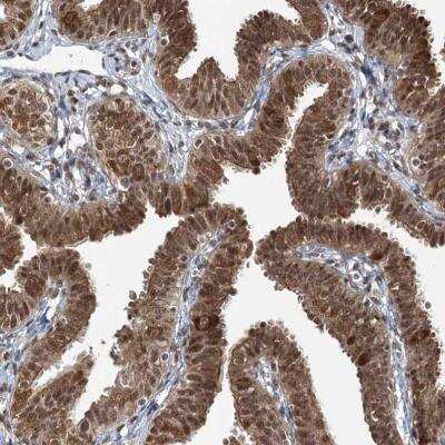 Immunohistochemistry: ZCCHC8 Antibody [NBP1-85134]