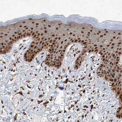 Immunohistochemistry: ZCCHC8 Antibody [NBP1-85134]