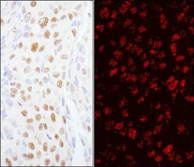Immunohistochemistry-Paraffin: ZCCHC8 Antibody [NB100-94995]