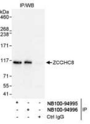 Immunoprecipitation: ZCCHC8 Antibody [NB100-94995]