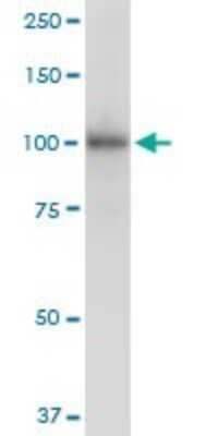 Western Blot: ZCCHC8 Antibody [H00055596-B01P]