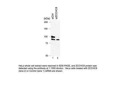 Western Blot: ZCCHC8 Antibody [NB100-94995]