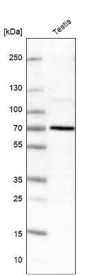 Western Blot: ZCCHC8 Antibody [NBP1-85134]