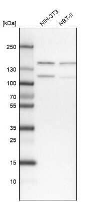 Western Blot: ZCCHC8 Antibody [NBP1-85134]
