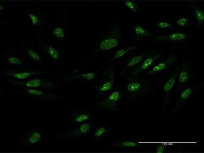 Immunocytochemistry/ Immunofluorescence: ZCCHC9 Antibody [H00084240-B01P]